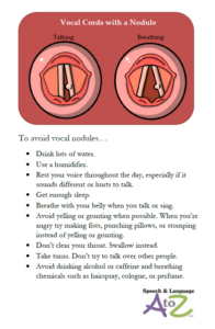 Free Vocal Hygiene Handout